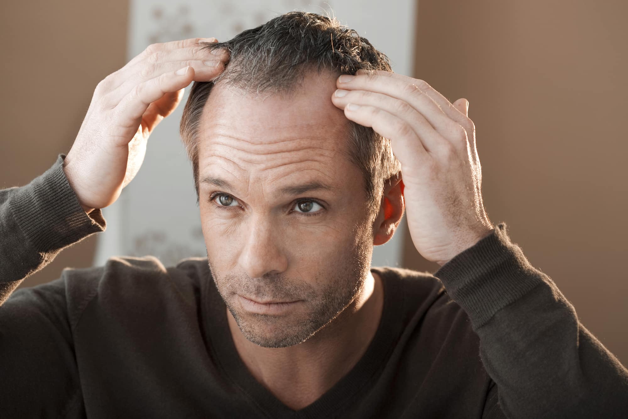 Männer kurze haarausfall haare 4 Kurzhaarfrisuren